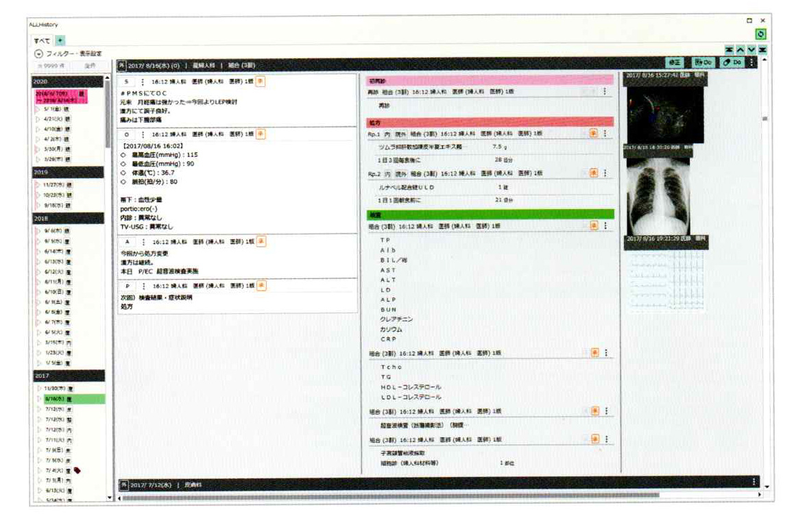 眼科専用の電子カルテシステムMediUS　CL