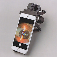 Mobile Slitlamp Microscope MS1