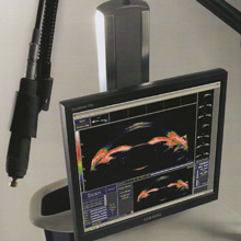 超音波生体顕微鏡 VuMaxⅡ